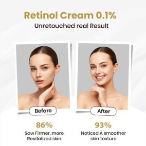 Retinol Cream 0.1% Repair | Moisturizer Face Cream, for Wrinkle Reduction, Non-Greasy Formula for Daily Use | 20g/0.70oz